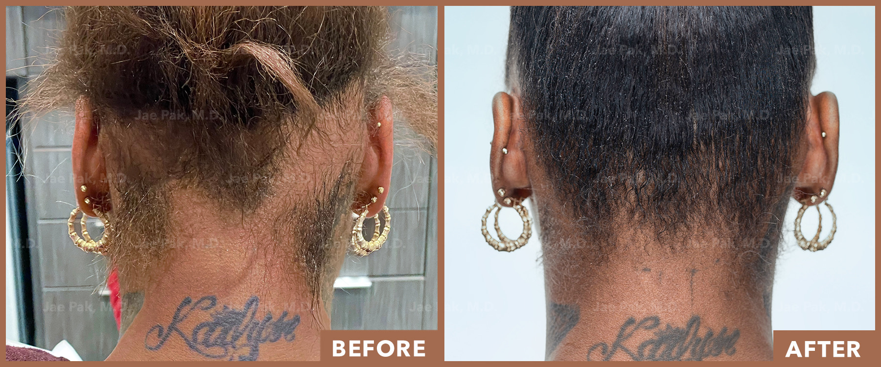 Actual Patient of Jae Pak, M.D