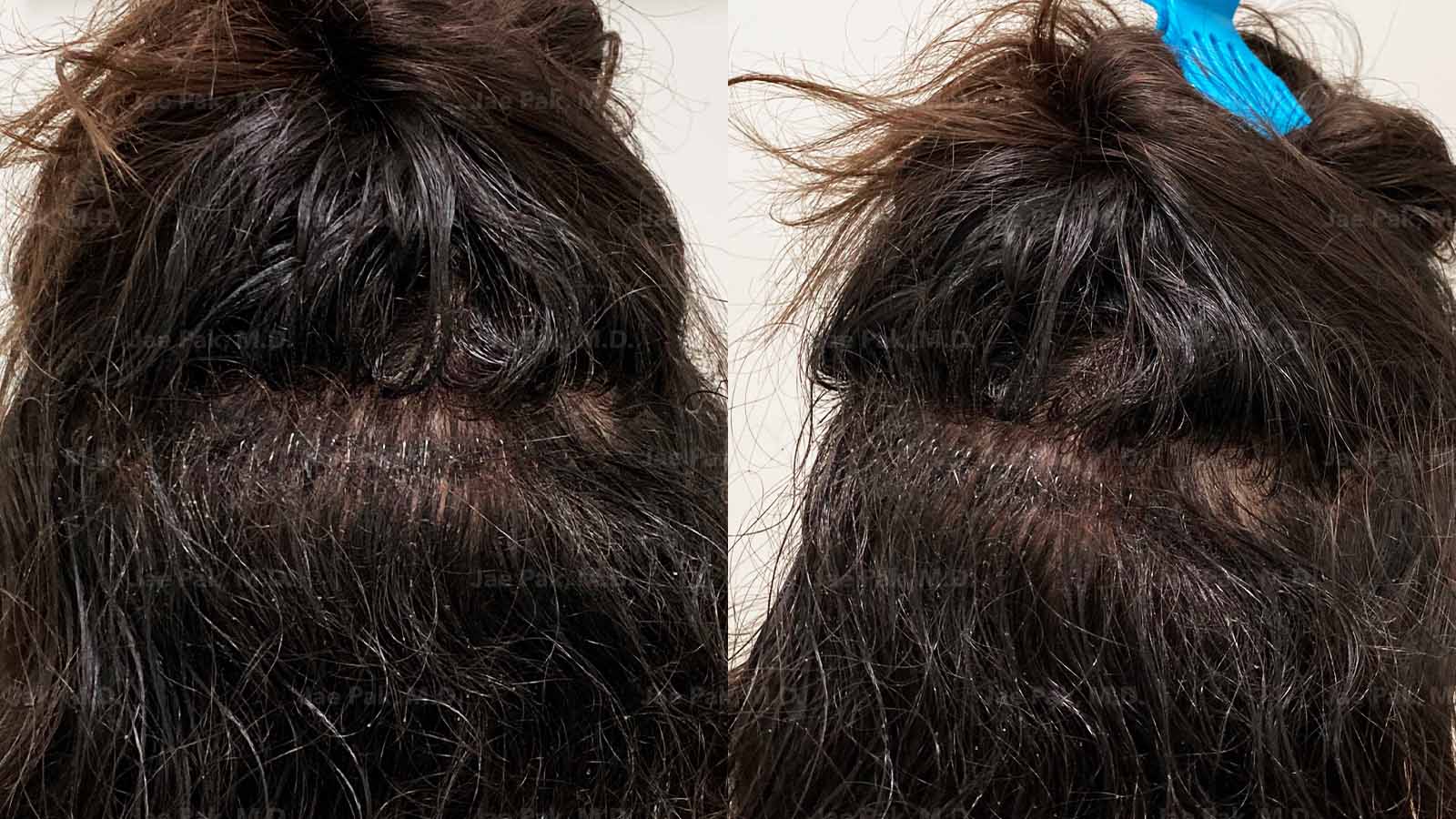 Actual Patient of Jae Pak, M.D