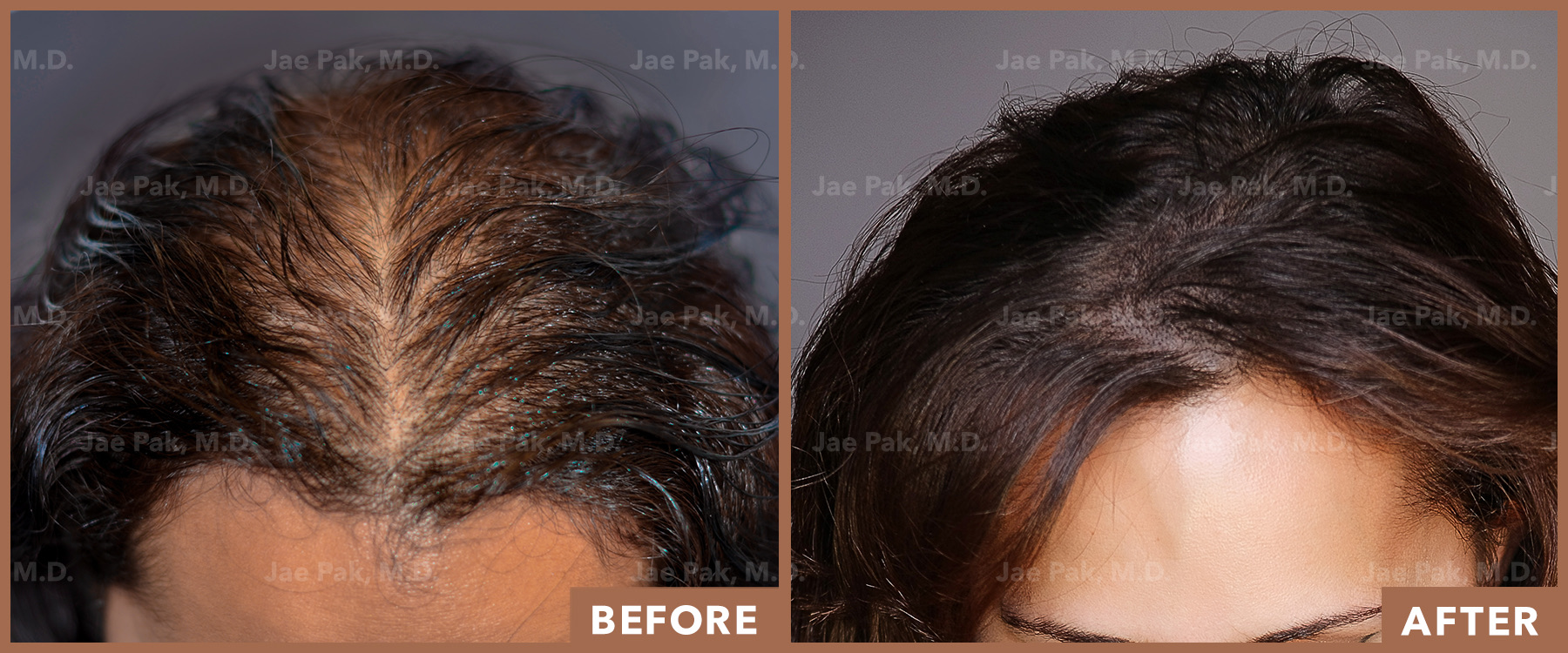 Actual Patient of Jae Pak, M.D