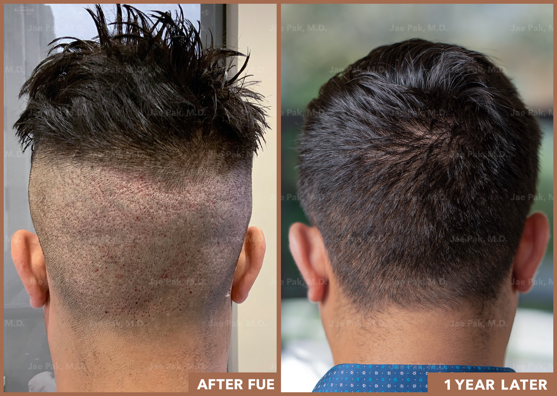 Actual Patient of Jae Pak, M.D