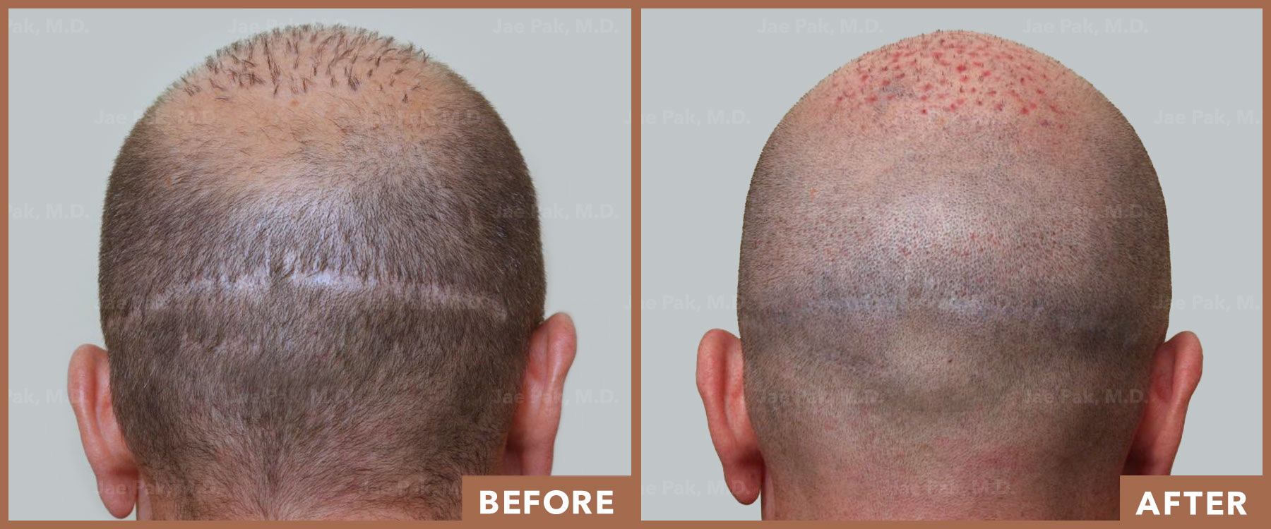 Actual Patient of Jae Pak, M.D