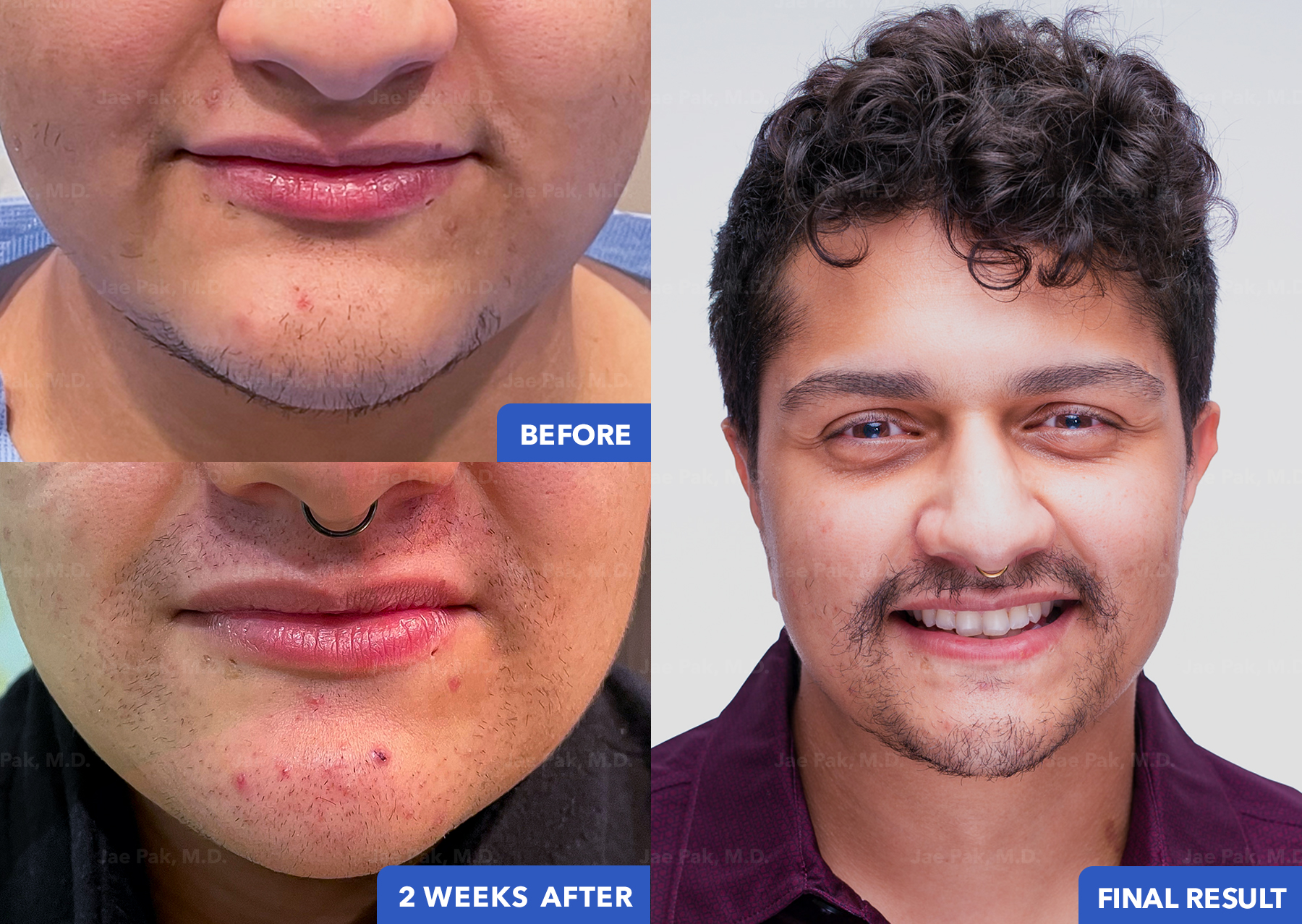 Actual Patient of Jae Pak, M.D