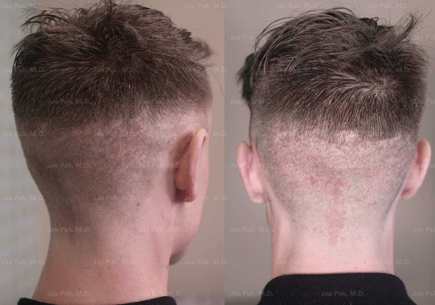 Actual Patient of Jae Pak, M.D