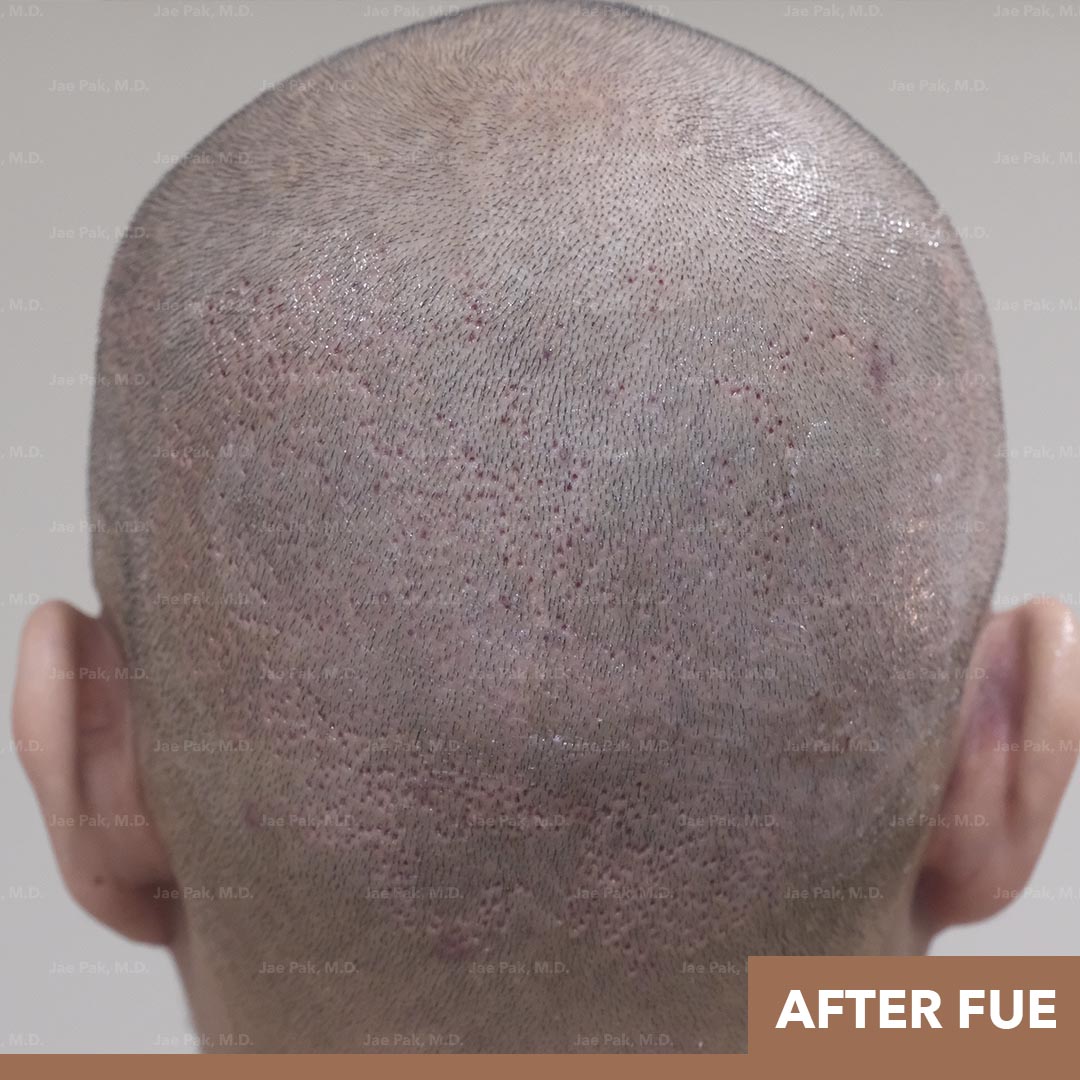 Actual Patient of Jae Pak, M.D