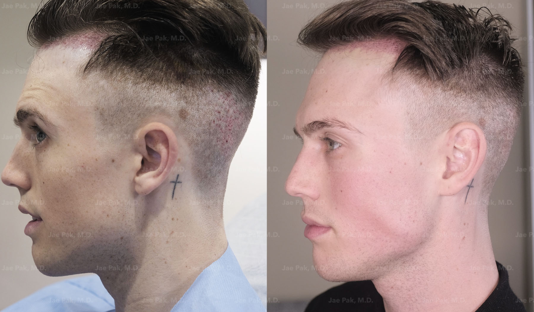 Actual Patient of Jae Pak, M.D