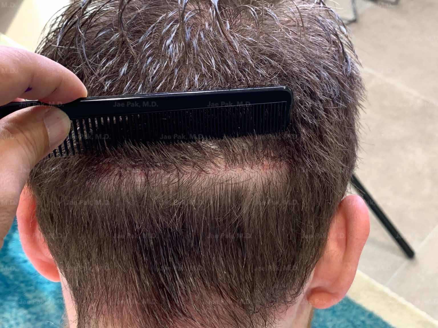 Actual Patient of Jae Pak, M.D