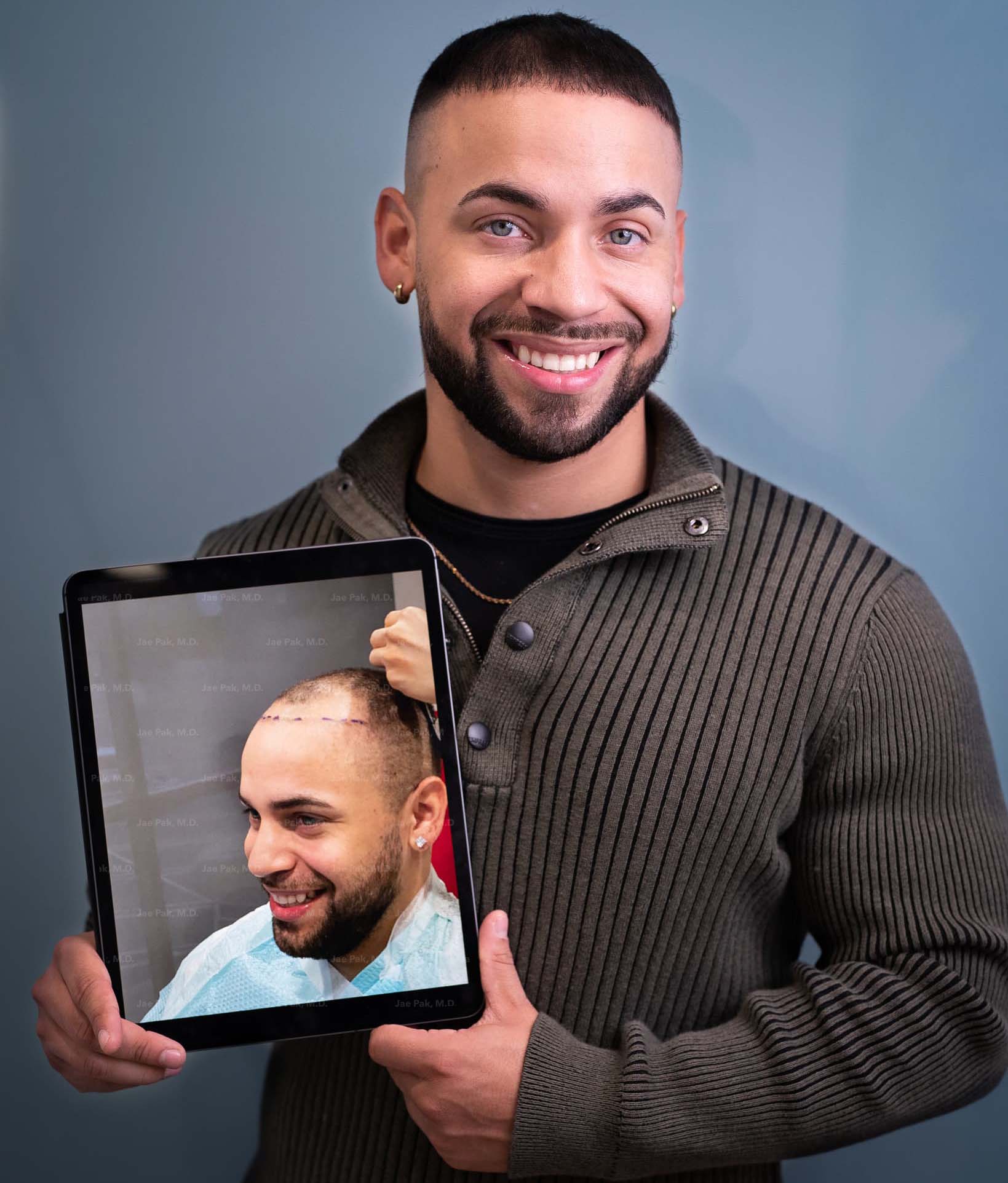 A picture of a man smiling in front of a camera while holding an image of himself while having a hair treatment