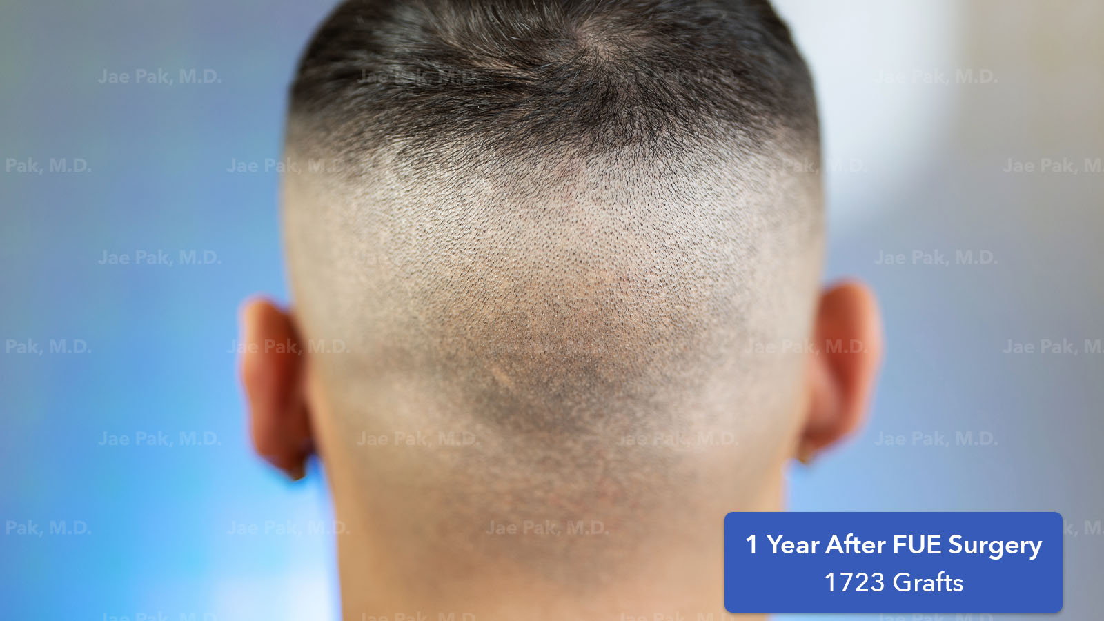 Actual Patient of Jae Pak, M.D