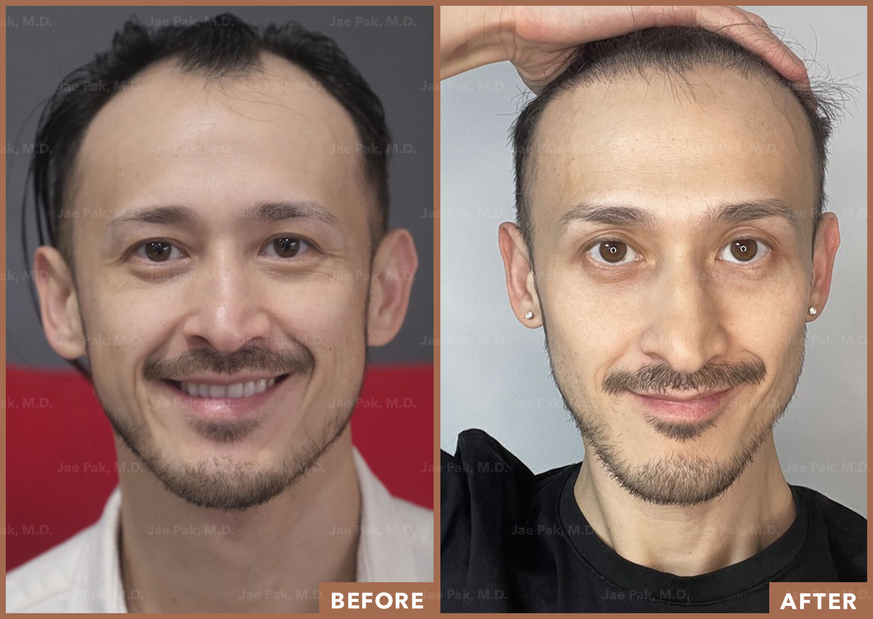 Actual Patient of Jae Pak, M.D