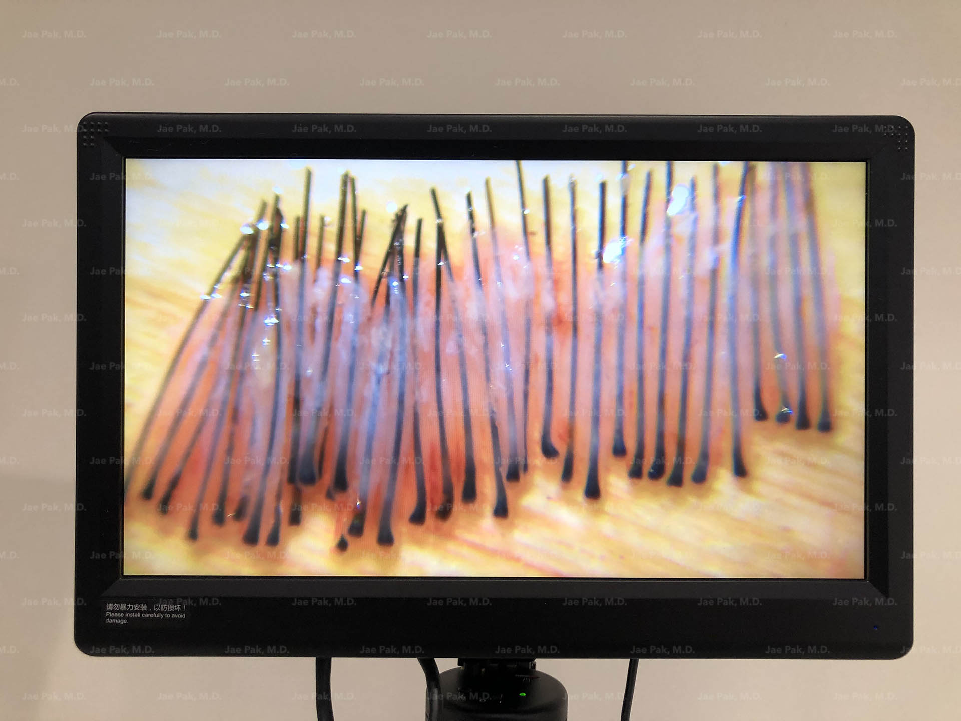 Actual Patient of Jae Pak, M.D