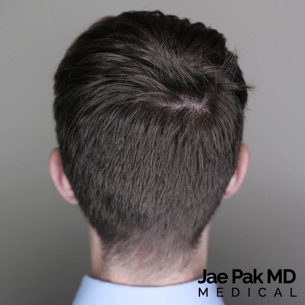 Actual Patient of Jae Pak, M.D