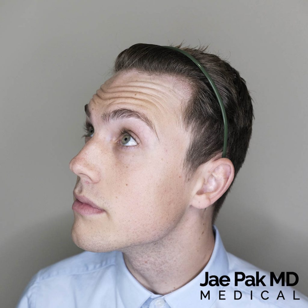 Actual Patient of Jae Pak, M.D