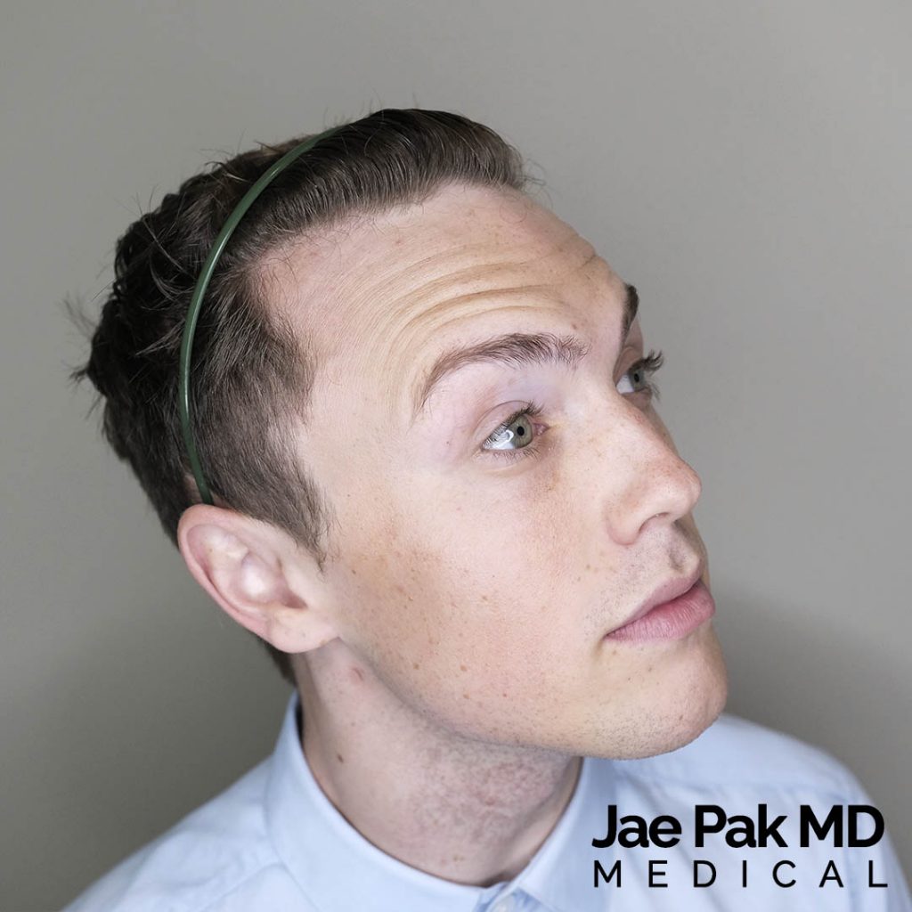Actual Patient of Jae Pak, M.D