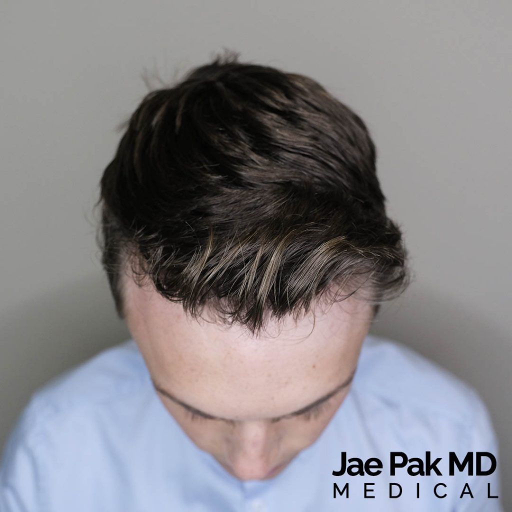Actual Patient of Jae Pak, M.D