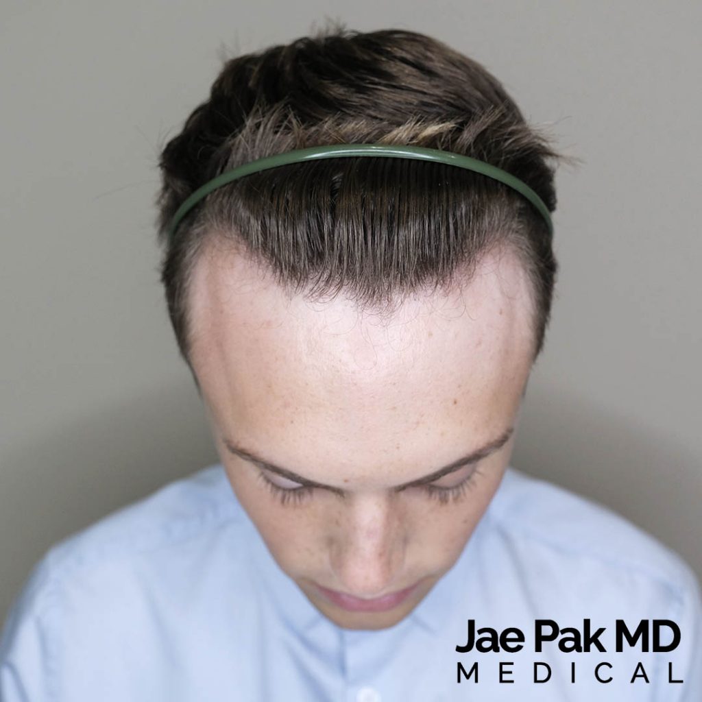 Actual Patient of Jae Pak, M.D