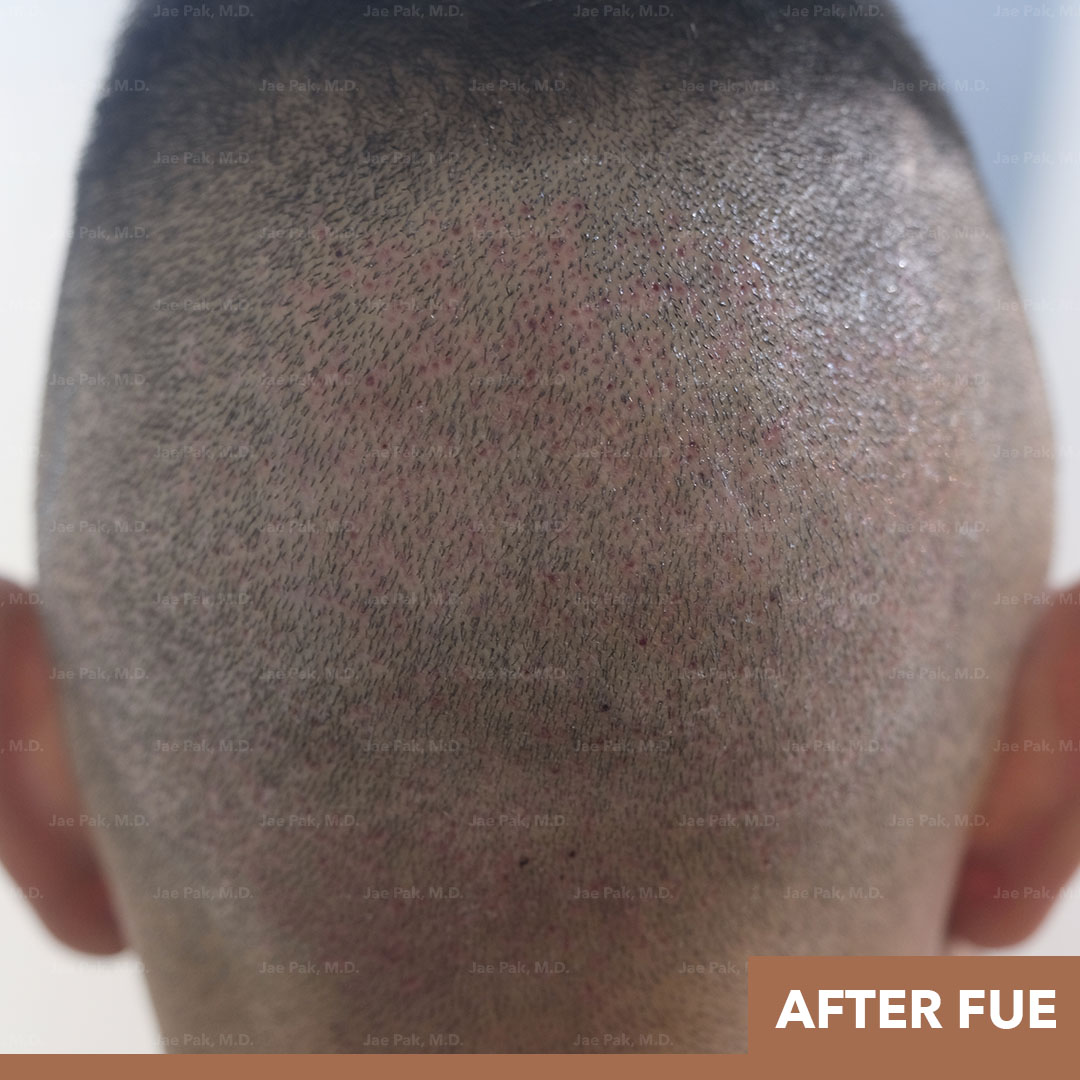 Actual Patient of Jae Pak, M.D