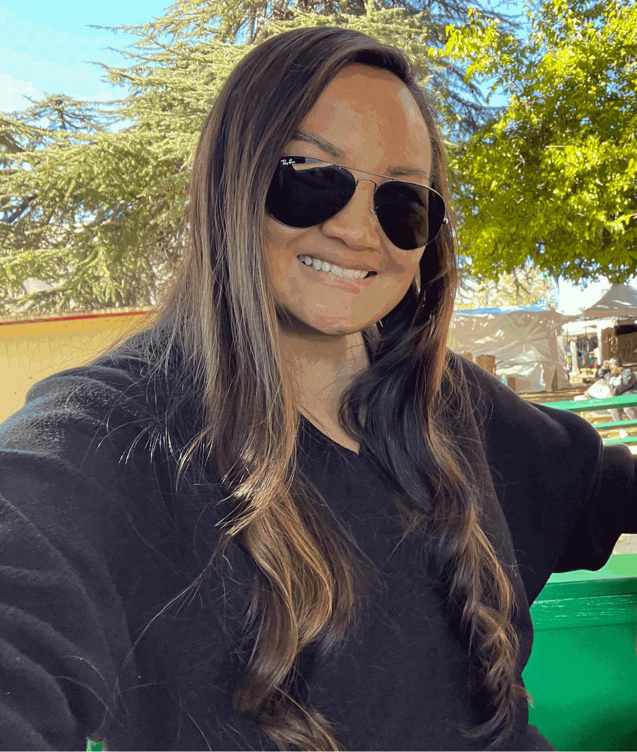 An image of Dr. Pak’s actual patient who underwent FUT hairline lowering. An internet personality shows her smile and her newly restored hairline.